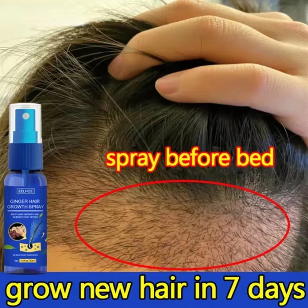 Spray de Crescimento Rápido de - Hair Care Lotion avaliação e preço